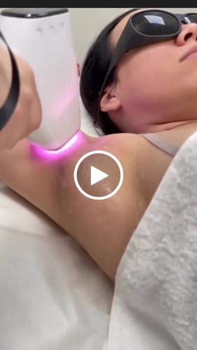 Customer video review of DiolaSheer Ice Hair Removal Laser Machine with Dual Handles