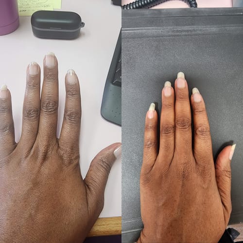 Customer photo review of Rocket Nail Fuel Nail Repair - Clear