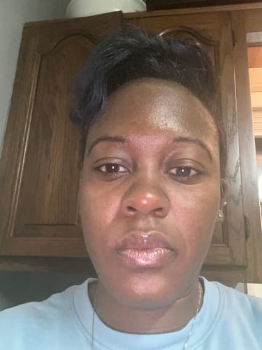 Customer photo review of BERRI-CLEAR+ 5 BERRY SUPERFRUIT SERUM