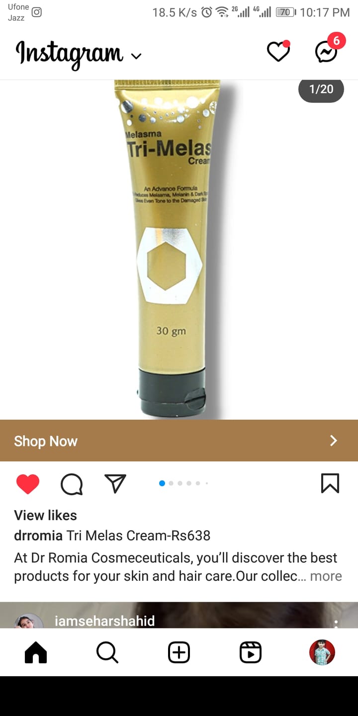 Customer photo review of Tri Melas Cream