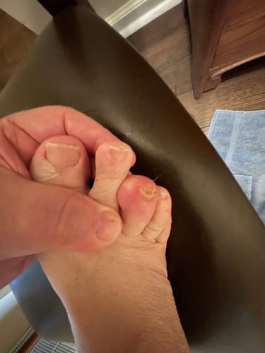 Customer photo review of Antifungal Laser Enhancer