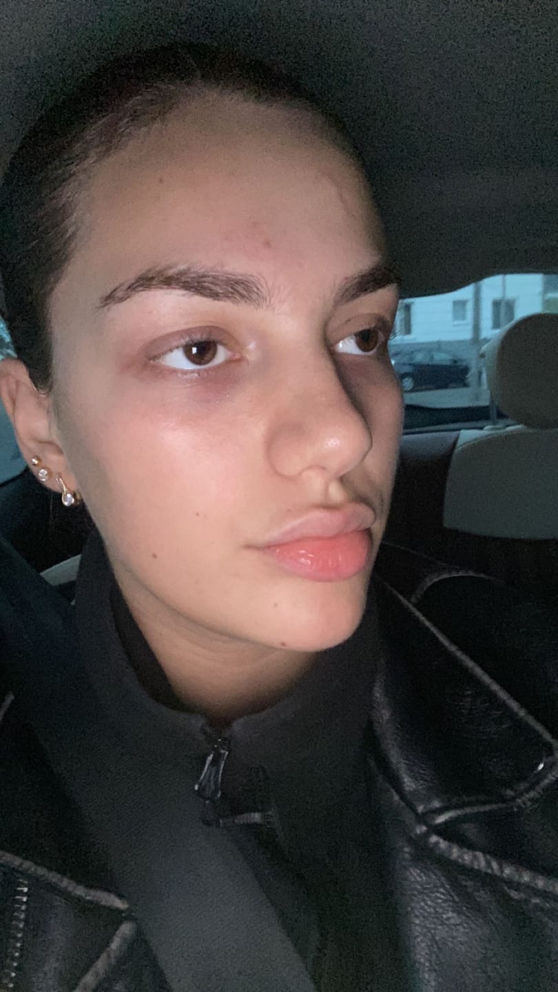 Customer photo review of Sleek Skin Serum 30ml