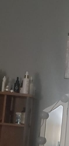 Customer photo review of Grow & Retain Scalp Spray