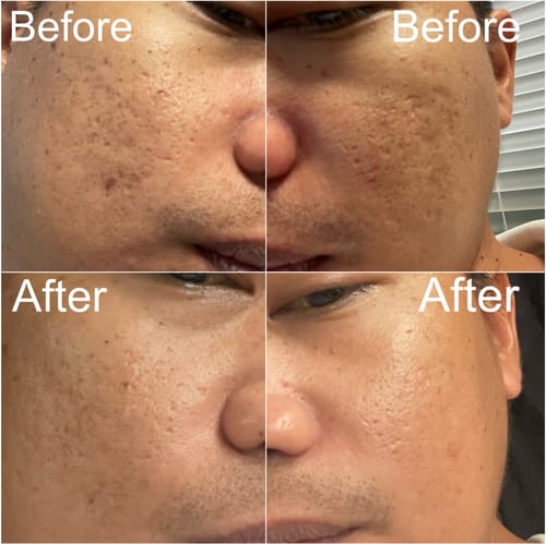 Customer photo review of Niacid