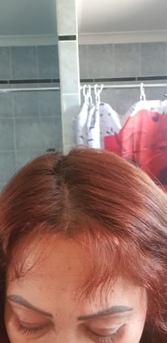 Customer photo review of Repair & Thickening - 10 Minute Miracle - Essential Bundle