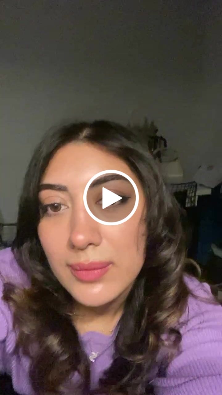 Customer video review of 2Dadoll Calico Brown Contact Lenses(1 pair/6 months)