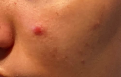 Customer photo review of Feuchtigkeitscreme