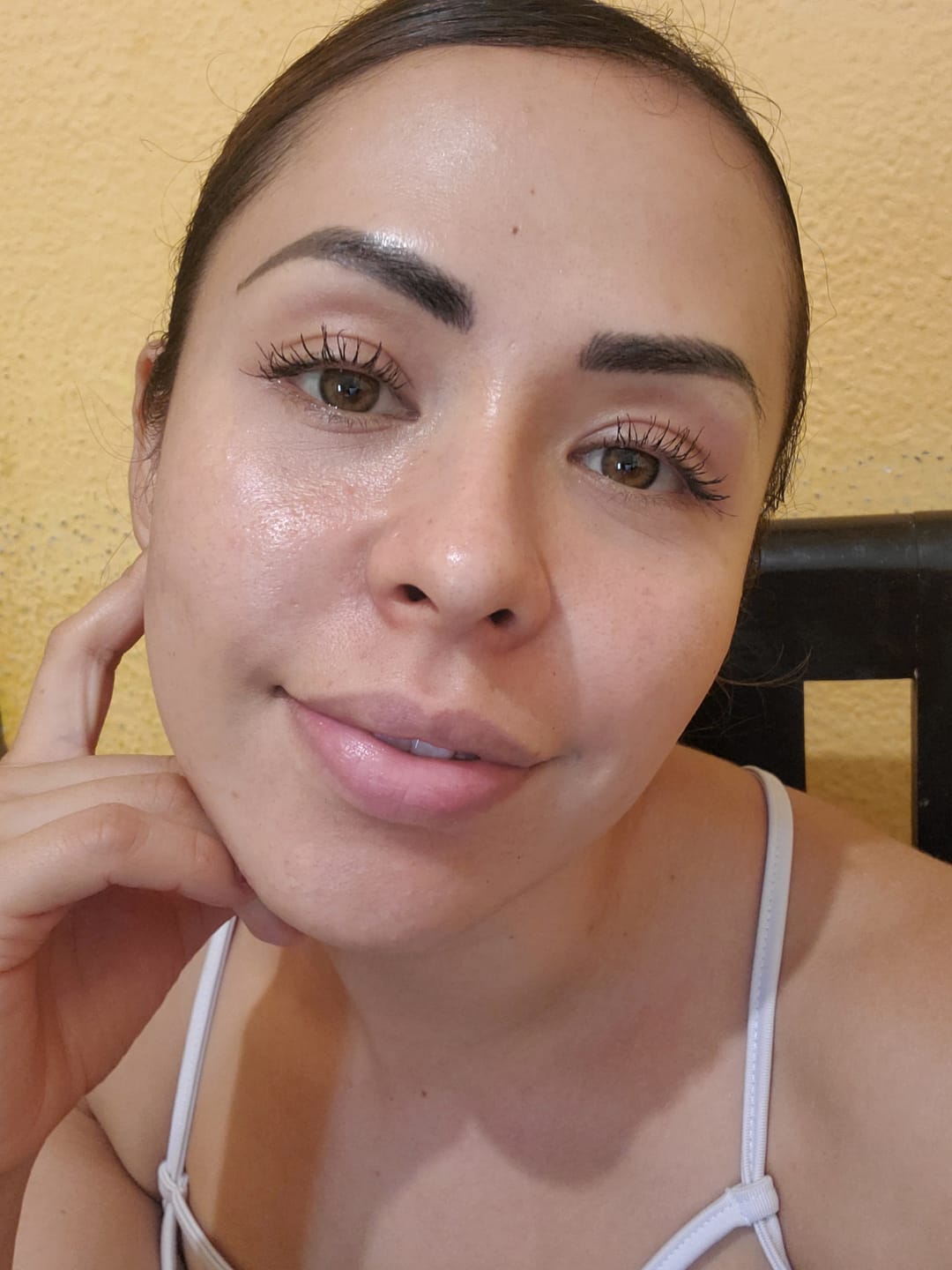 Customer photo review of Kit Los Esenciales (29% OFF) - Serum de Vitamina C 30ml + Serum de Niacinamida 30ml + Serum de Ácido Hialurónico 30ml