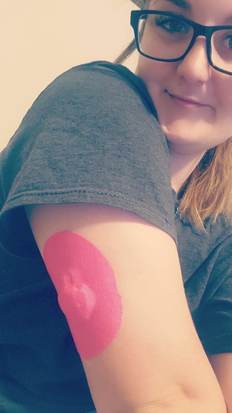 Customer photo review of Skin Grip Original - Medtronic Guardian/Enlite Adhesive Patches