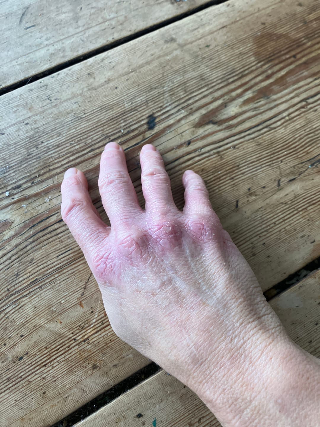 Customer photo review of Prebiotic Hand Cream
