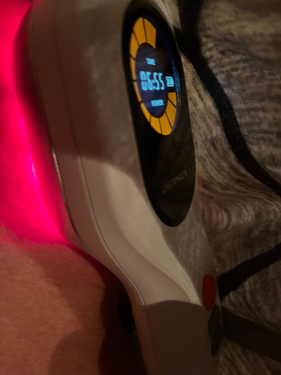 Customer photo review of DERNOX™ Handheld Cold Laser Device