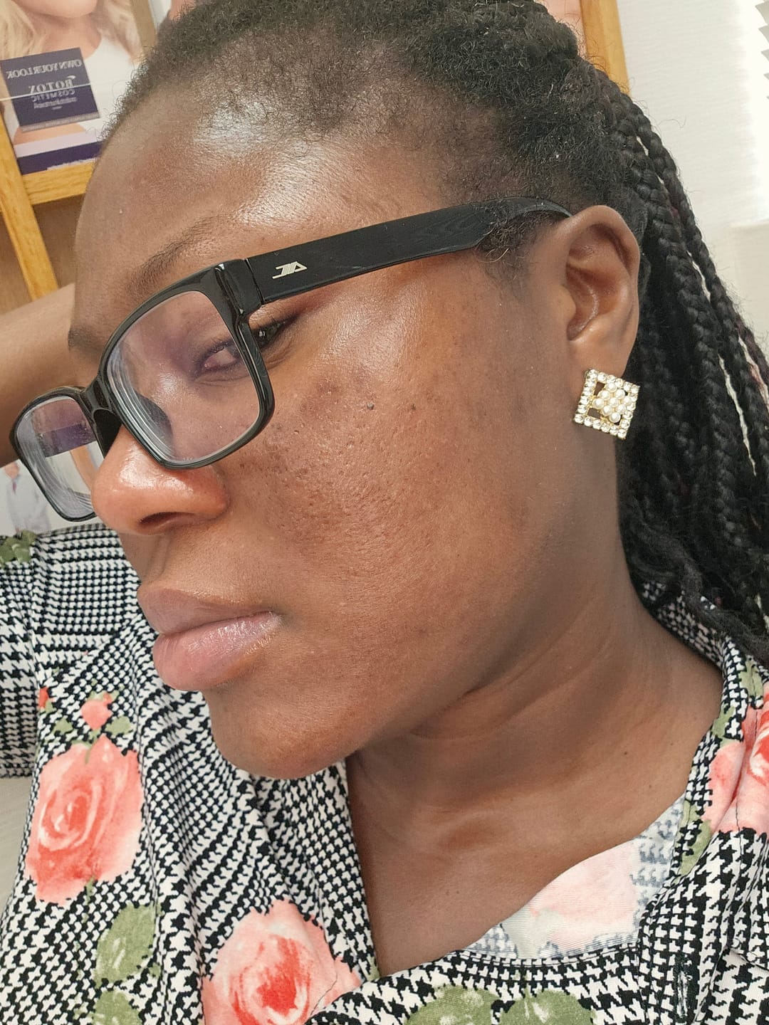 Customer photo review of PURIFYING FACE & BODY SCRUB