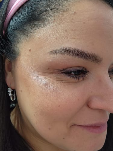 Customer photo review of Serum Antiage 30ml