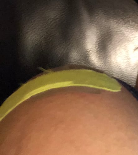 Customer photo review of Body Relief Patch -20 Pack!