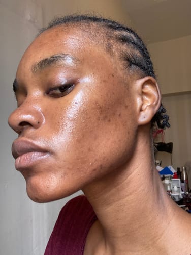 Customer photo review of BERRI-CLEAR+ 5 BERRY SUPERFRUIT SERUM