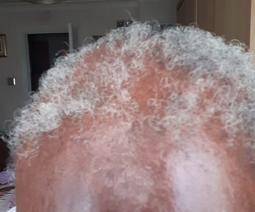 Customer photo review of Hair Growth Potion