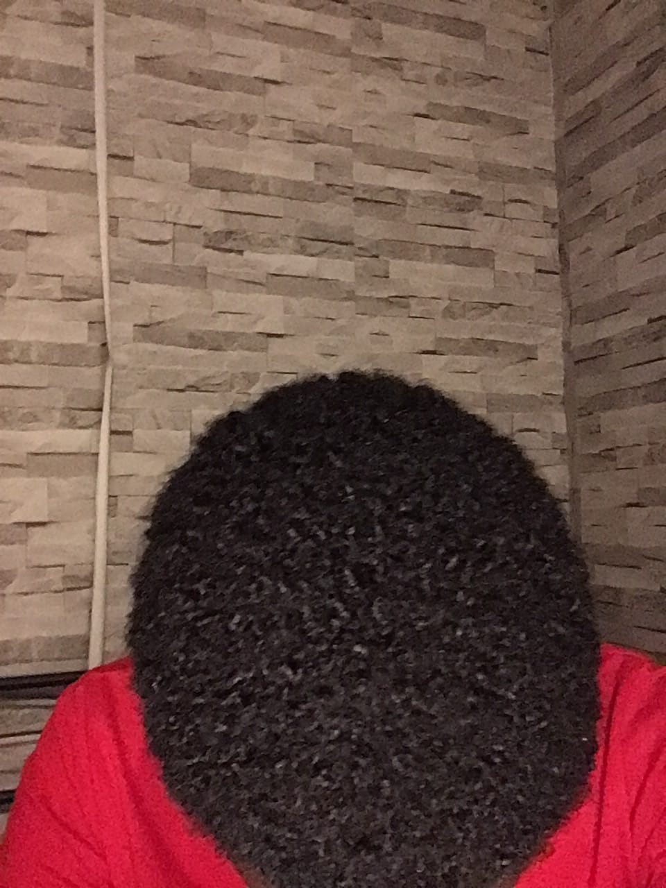 Customer photo review of Hair Recovery Bundle