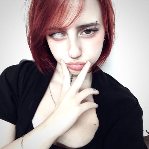 Customer photo review of Blind Moon Light Contact Lenses(12 months of use)