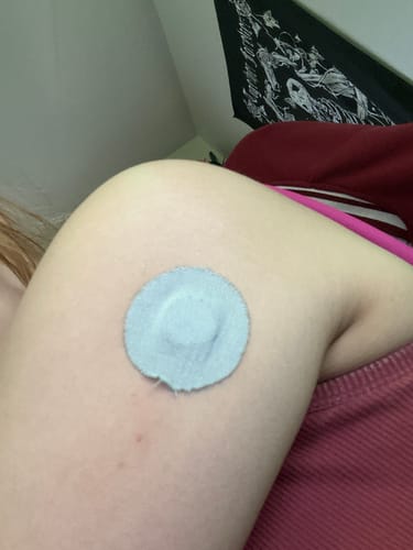 Customer photo review of Skin Grip Original - Freestyle Libre 3 Adhesive Patches