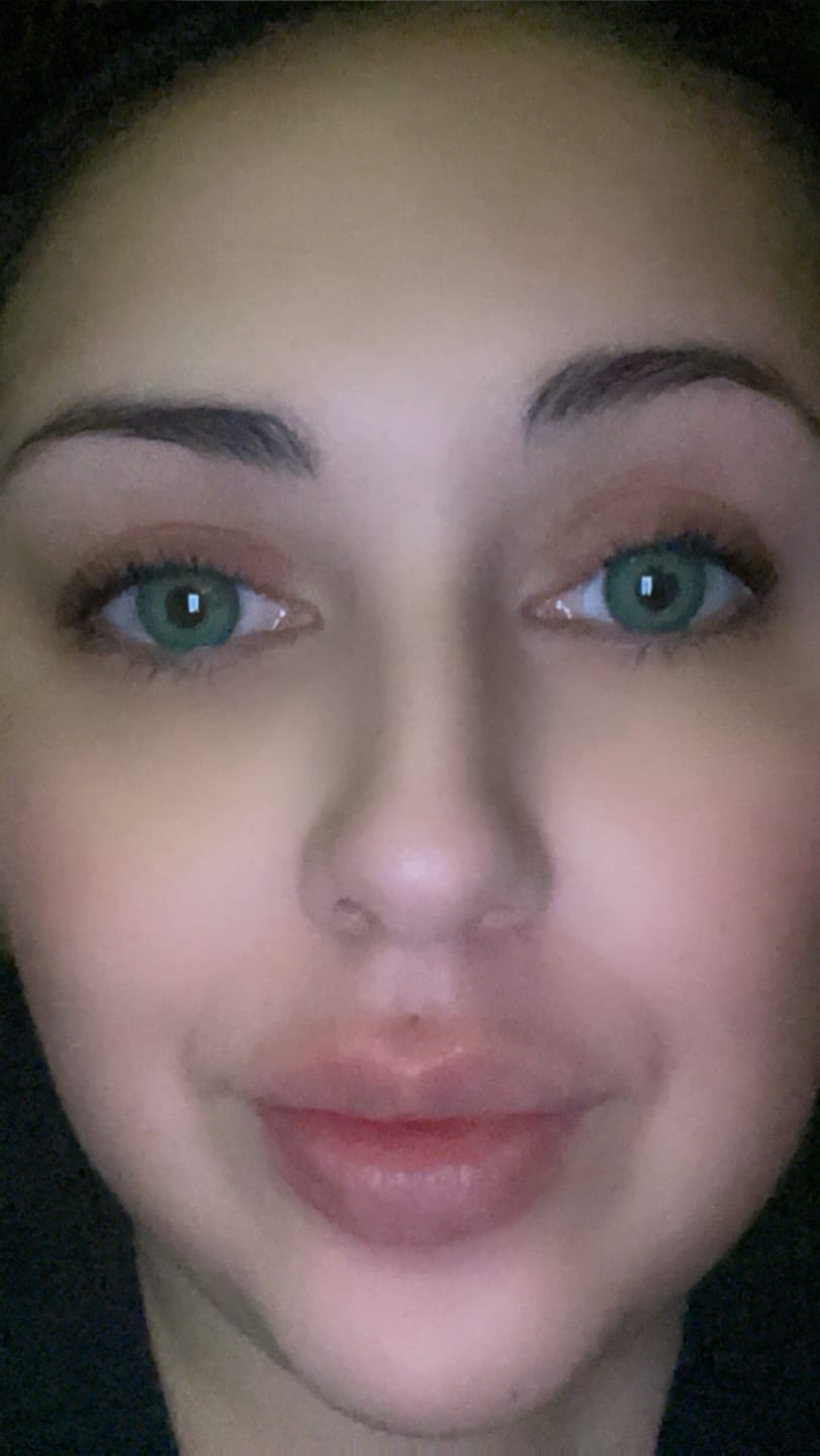 Customer photo review of Himalaya Green Prescription Coloured Contact Lenses
