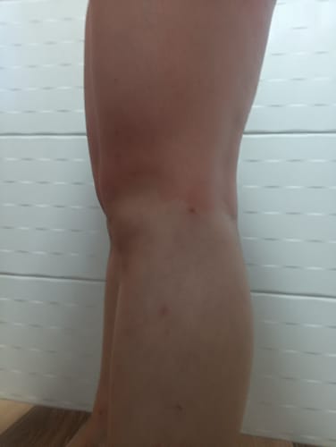 Customer photo review of KIT CUIDADO DIÁRIO