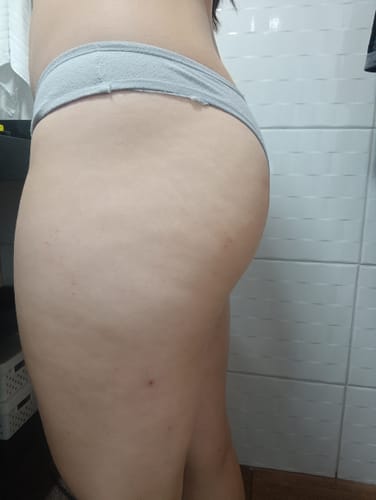 Customer photo review of KIT CUIDADO DIÁRIO