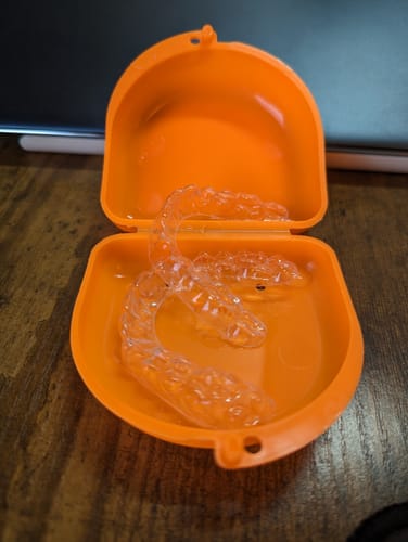 Customer photo review of Upper and Lower Retainers Set