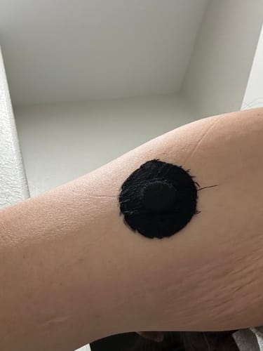 Customer photo review of Skin Grip Original - Freestyle Libre 3 Adhesive Patches