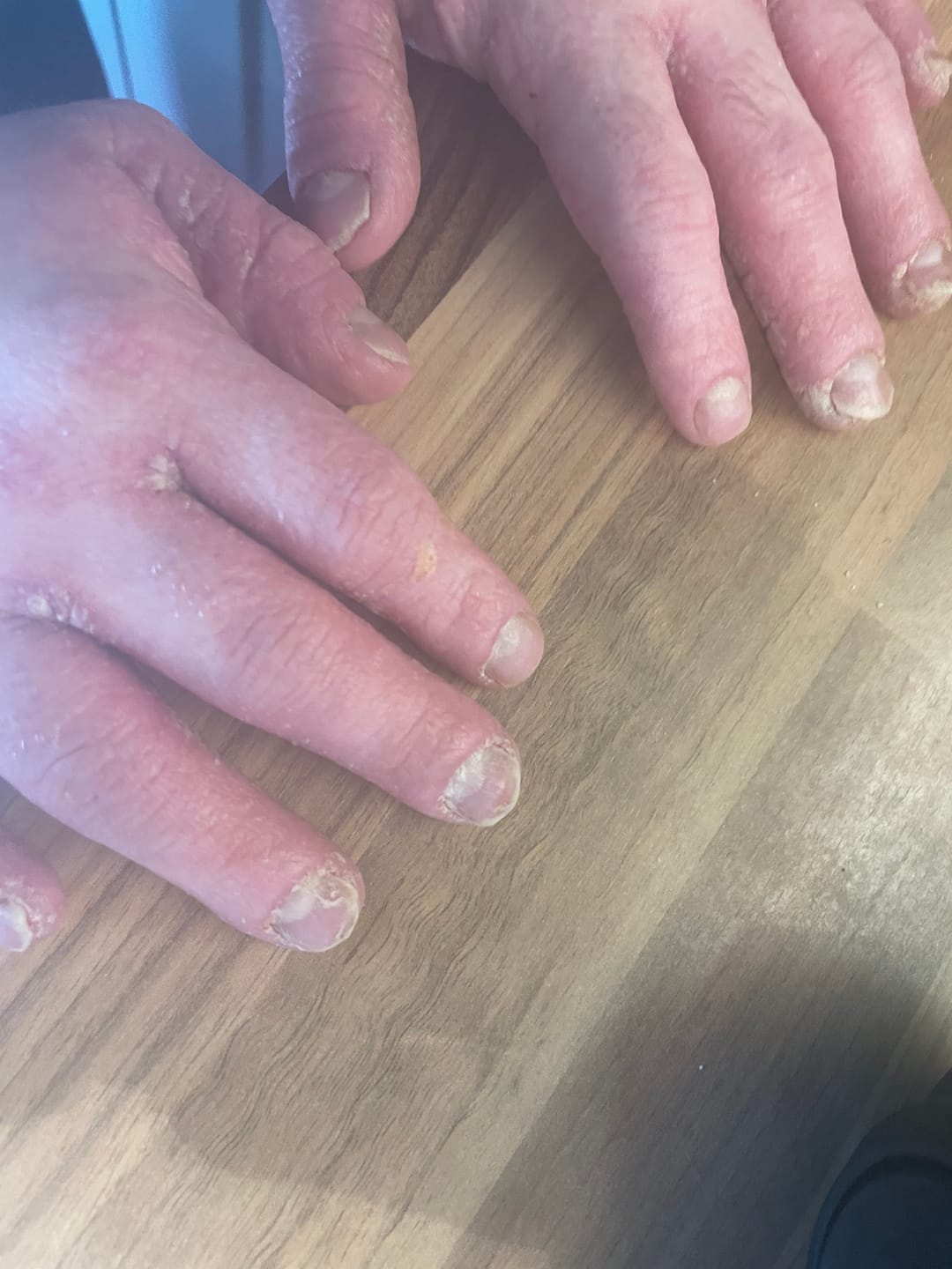 Customer photo review of Prebiotic Hand Cream