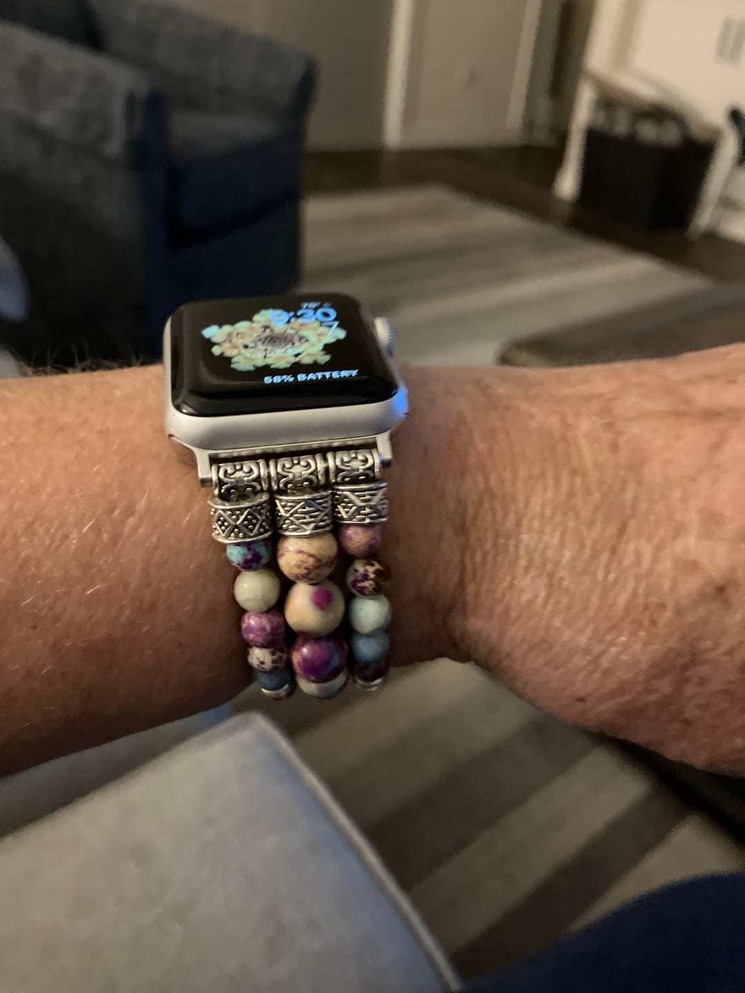 Customer photo review of Intense Jasper Stretch Apple Watch Strap