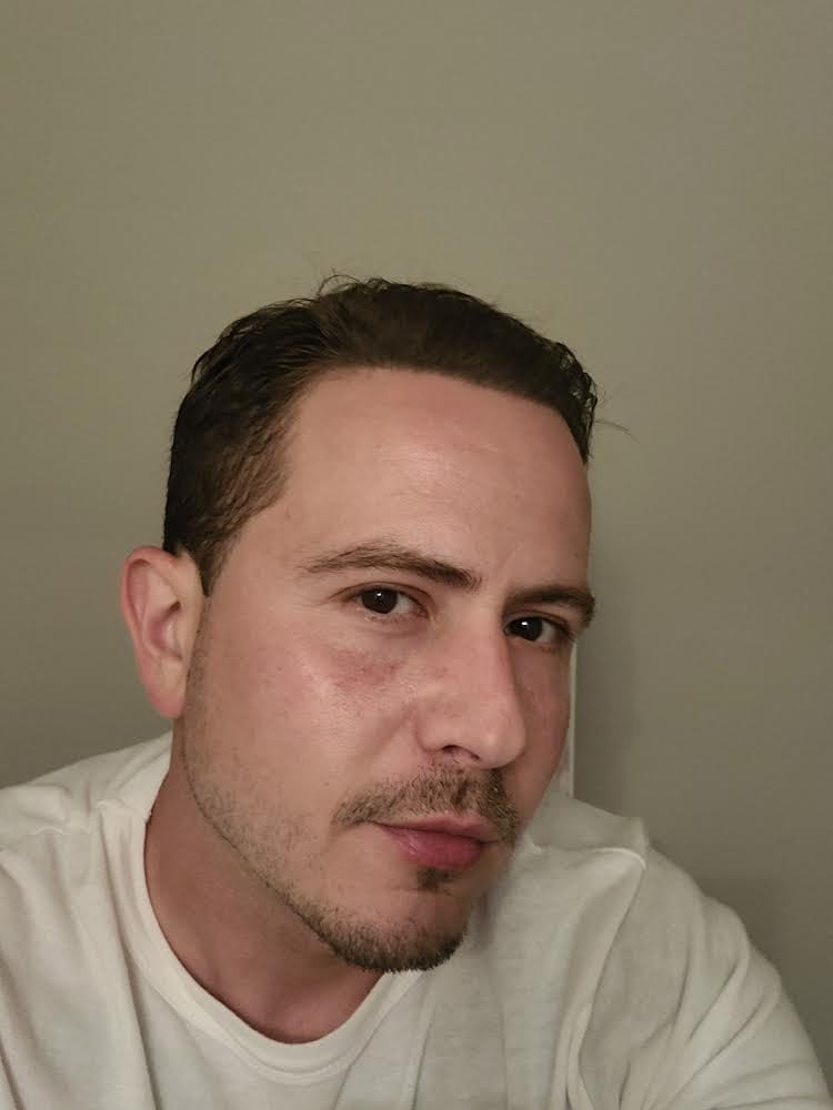 Customer photo review of VITAFOAM ™ & Scalp Roller Hair Growth Kit