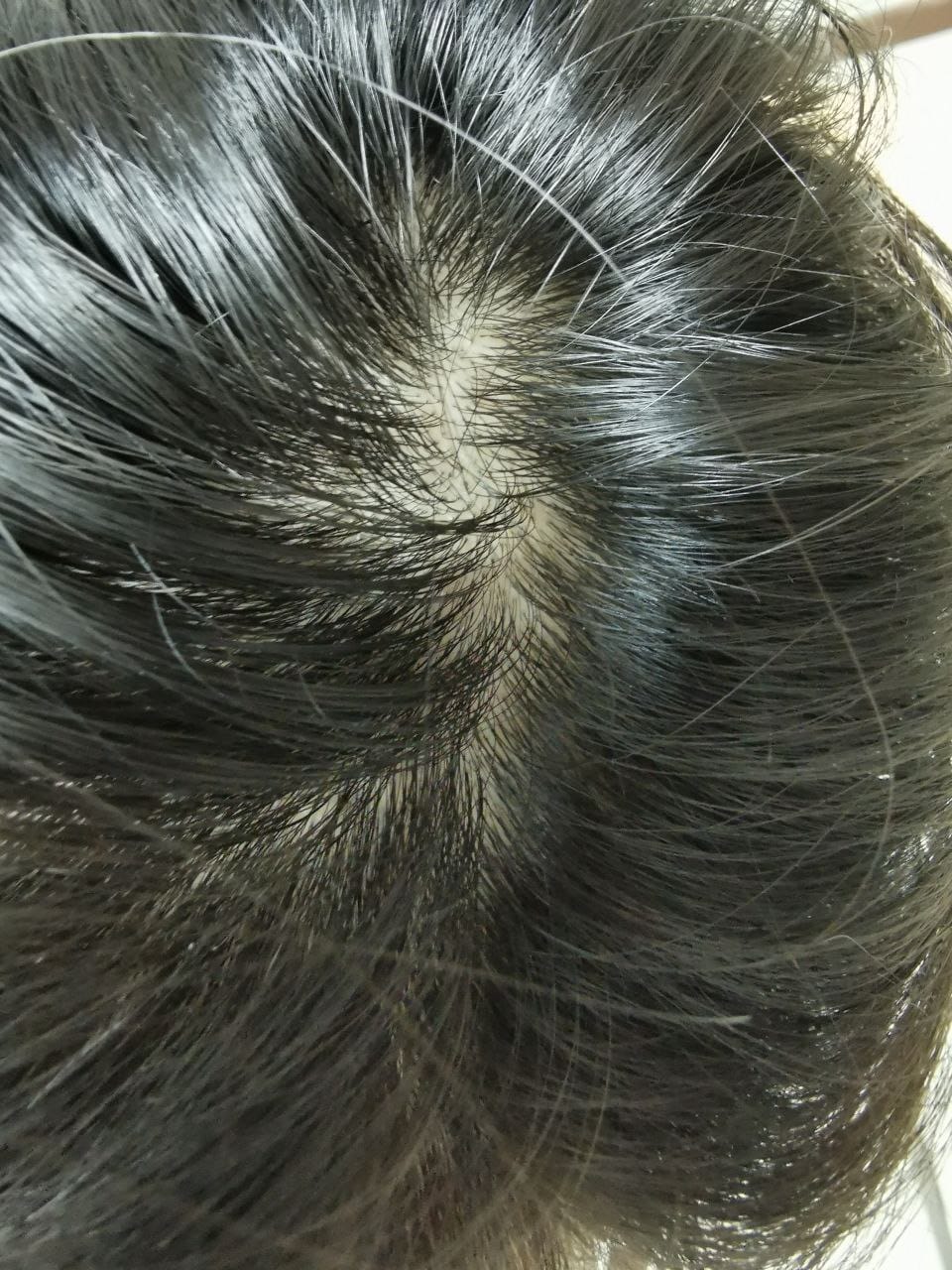 Customer photo review of [ SMIB ] - 500ML Coral Calcium Shampoo