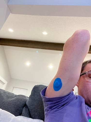 Customer photo review of Skin Grip Original - Freestyle Libre 3 Adhesive Patches