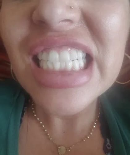 Customer photo review of Farbkorrektur - Serum