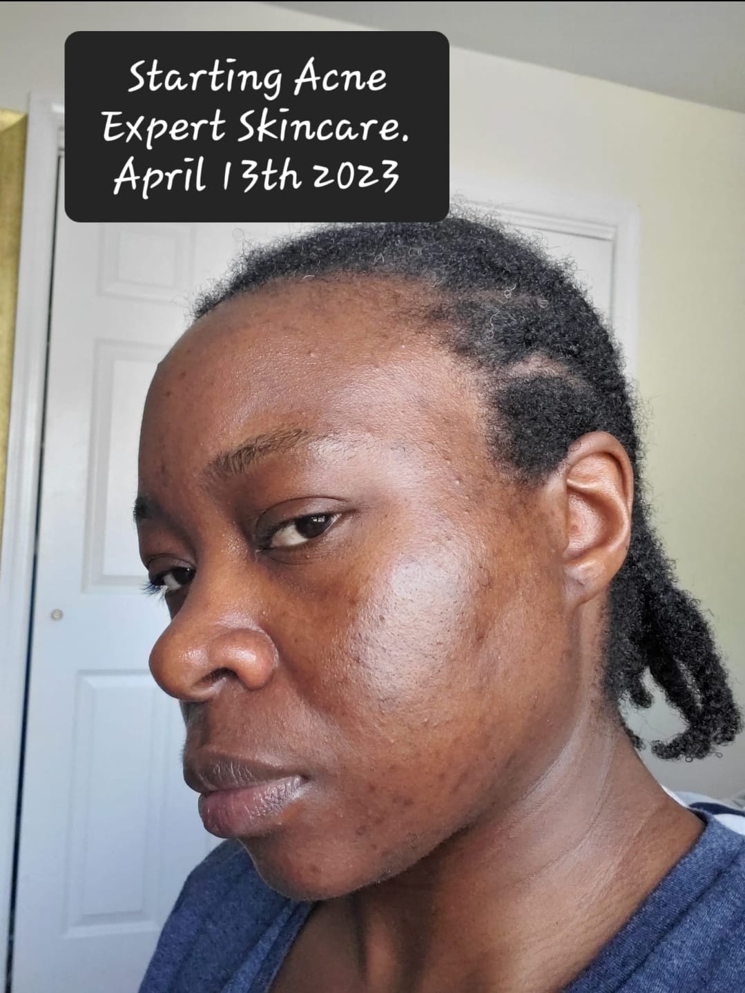 Customer photo review of PURIFYING TONER