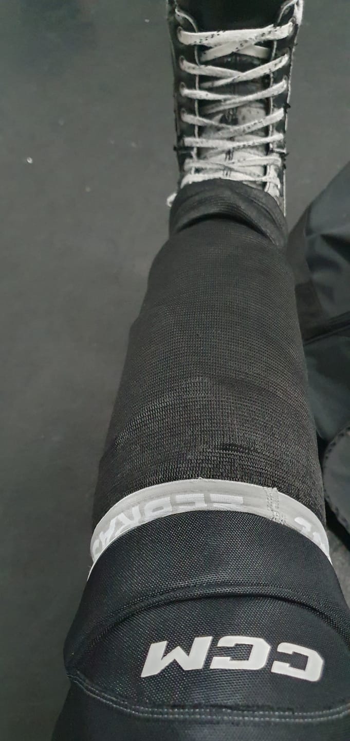 Customer photo review of ZEBRASCLUB COMPRESSION SHIN SLEEVE