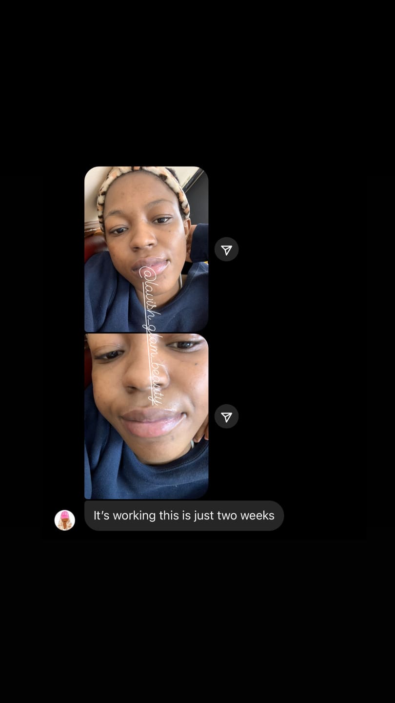 Customer photo review of Pink Lip Kit