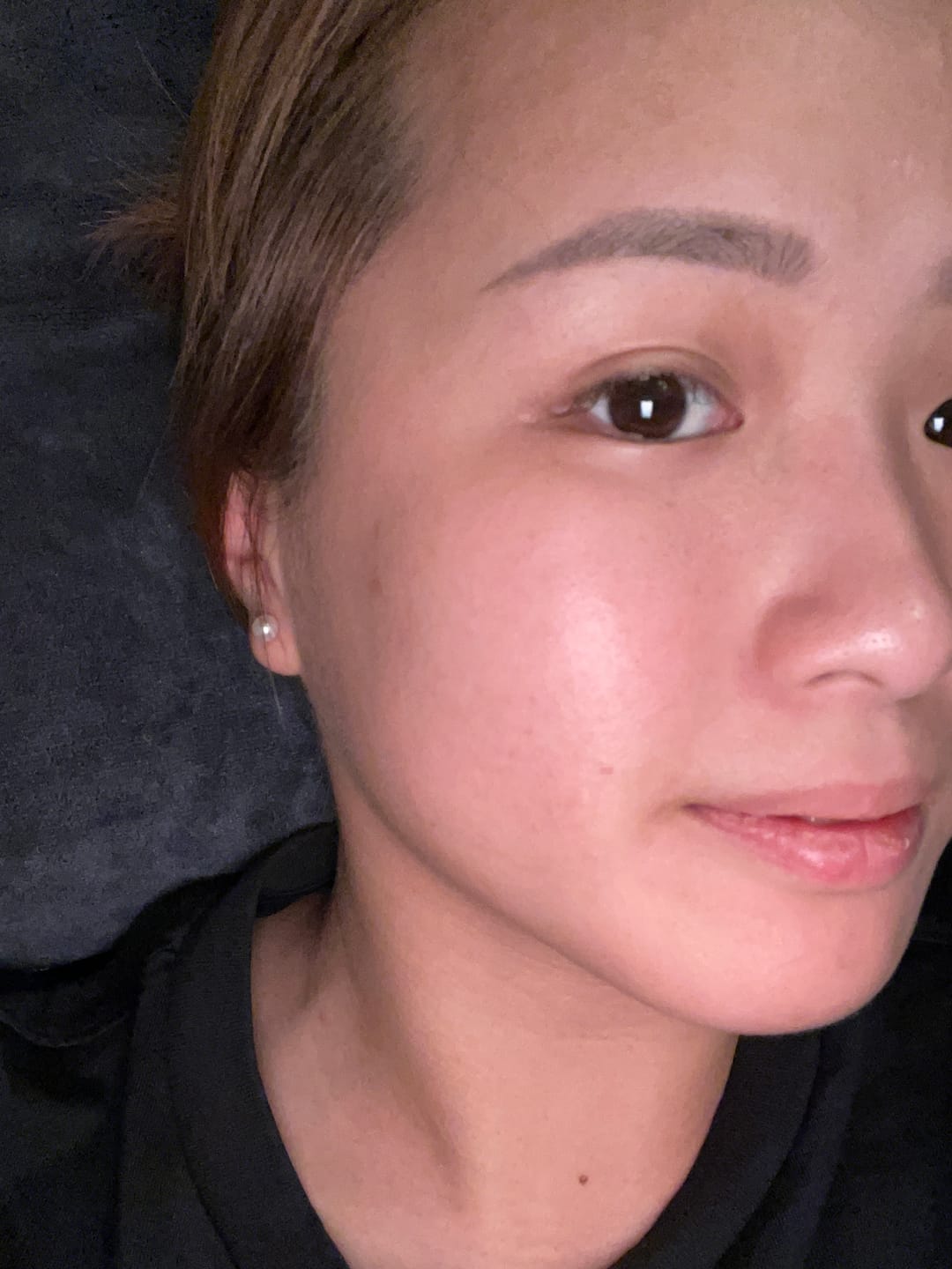 Customer photo review of Hyaluronic Boost Super Serum