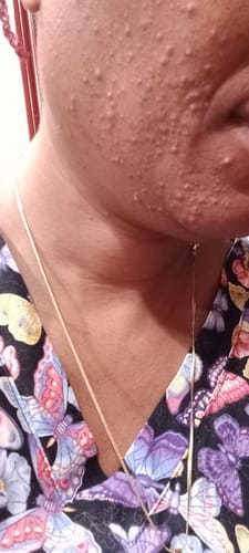 Customer photo review of GLOW COMBO