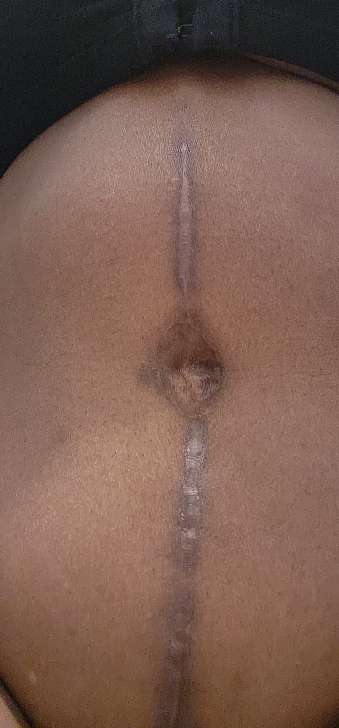Customer photo review of Magic Eraser Dark Spot Cream