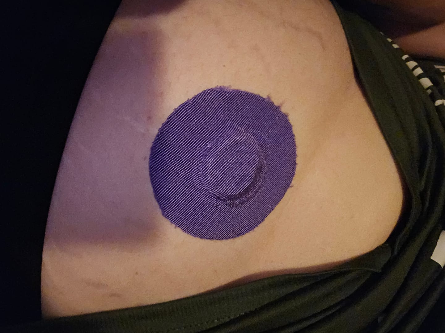 Customer photo review of Skin Grip Original - Dexcom G7 Adhesive Patches