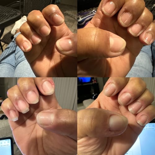 Customer photo review of Conceal & Repair Kit