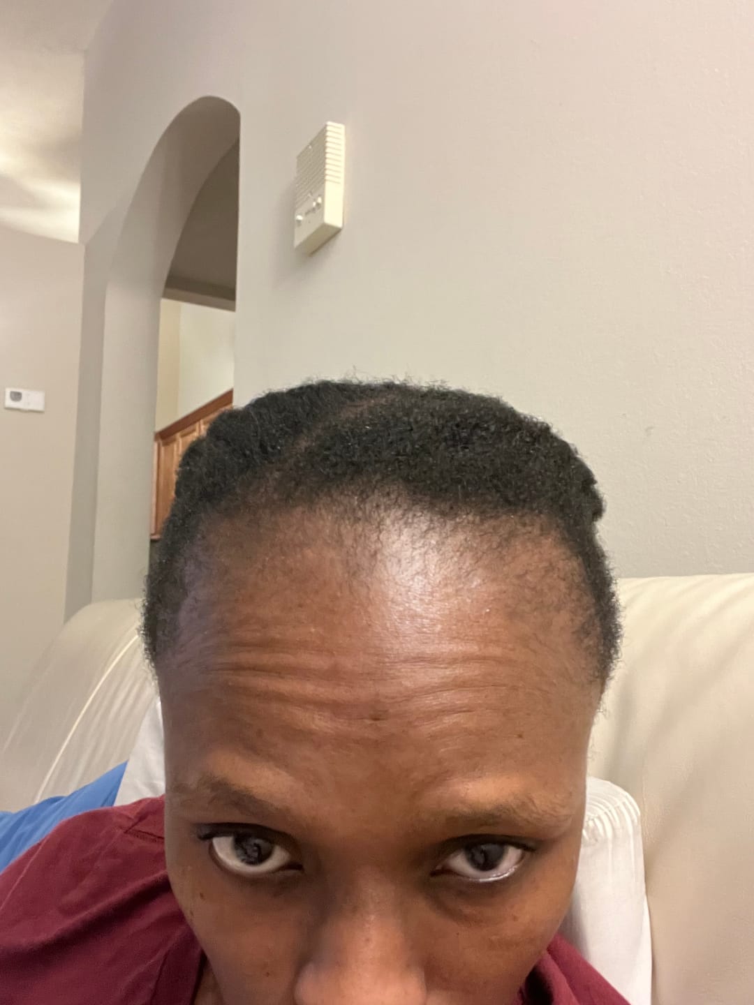 Customer photo review of Hair Recovery Bundle