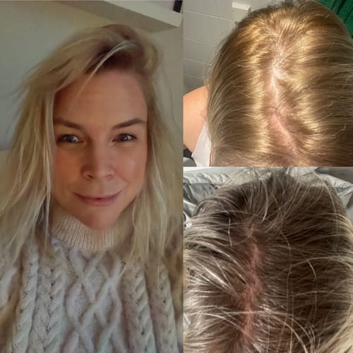 Customer photo review of Black Week Kit - Save 40%