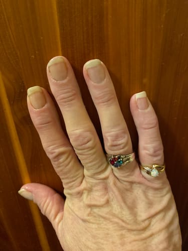 Customer photo review of Rocket Nail Fuel Nail Repair - Clear
