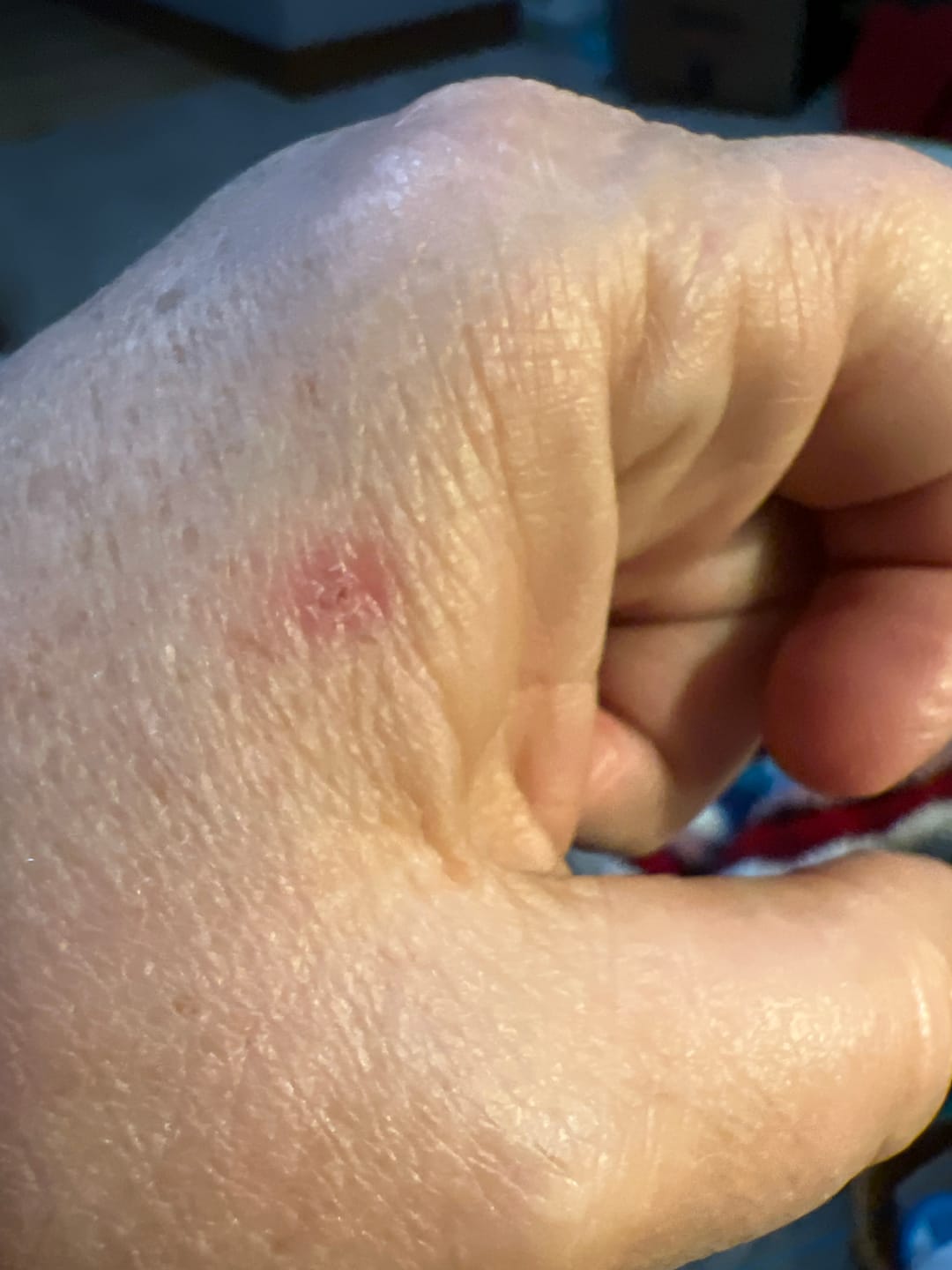 Customer photo review of Heal Stick