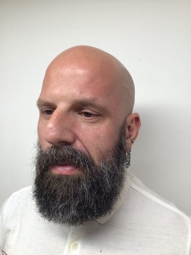 Customer photo review of EyeFix: Filler