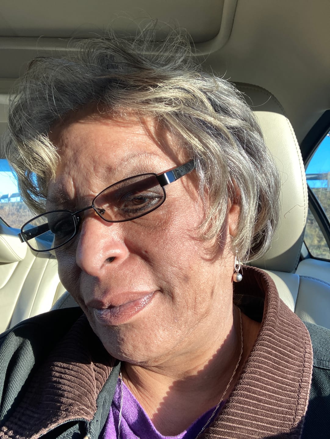 Customer photo review of Magic Eraser Dark Spot Cream