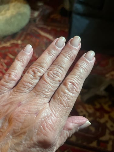 Customer photo review of Rocket Nail Fuel Nail Repair - Clear