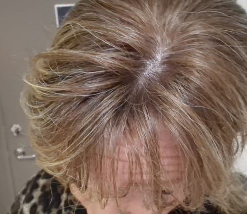 Customer photo review of Black Week Kit - Save 40%